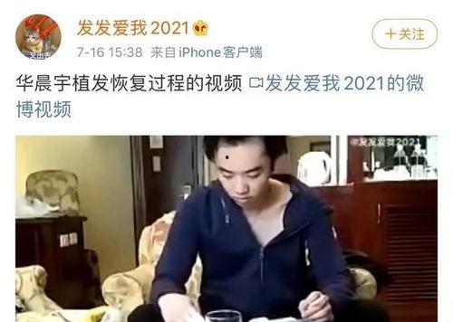 华晨宇爆料秃头视频,揭秘明星背后的健康困扰